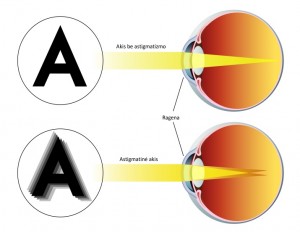 astigmatizmas